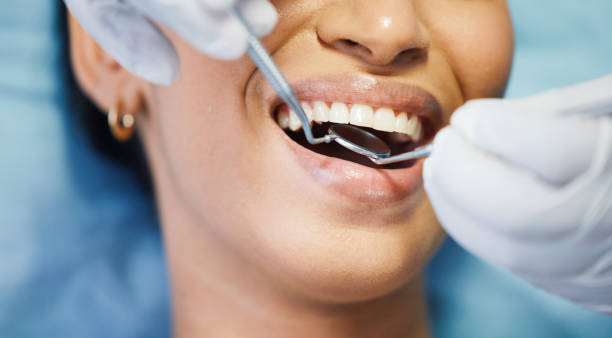 Best Chipped Tooth Repair Near Me  in Pinson, AL